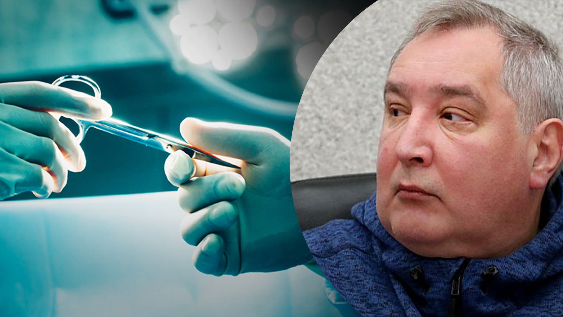 Рогозина в Москве сделают операцию: во время обстрела получил контузию и ранил лопатку - 24 Канал Рогозина в Москве сделают операцию: во время обстрела получил контузию и ранил лопатку - 24 Канал