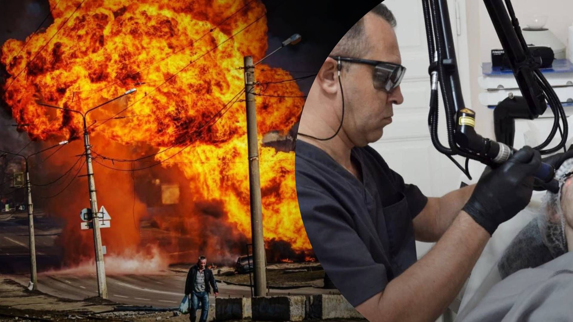 Неопалимі лікують опіки - як безкоштовно вилікувати опіки отриманні внаслідок війни Неопалимі лікують опіки - як безкоштовно вилікувати опіки отриманні внаслідок війни