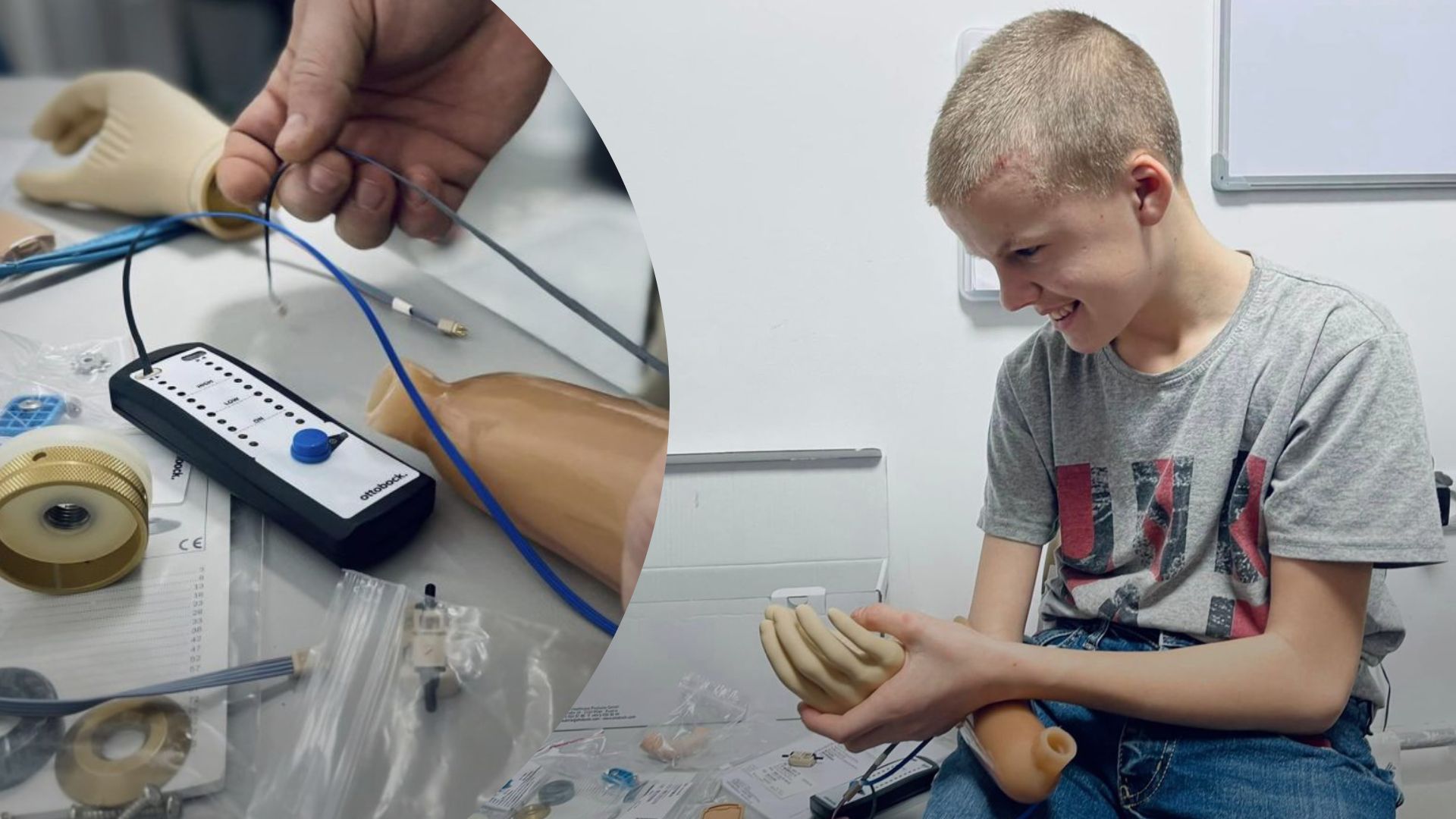 Во Львове протез руки установят 13-летнему сыну защитника Украины - что с ним произошло