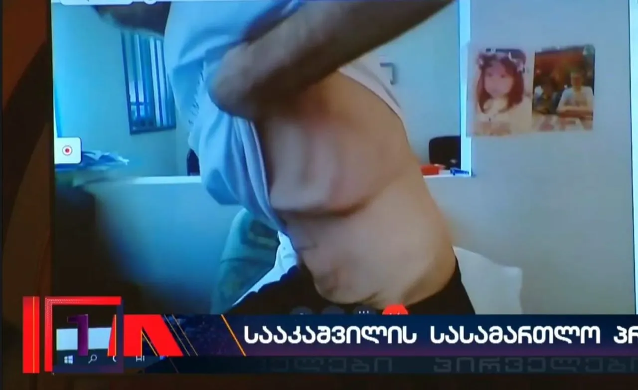 Стан Міхеіла Саакашвілі справді критичний Стан Міхеіла Саакашвілі справді критичний