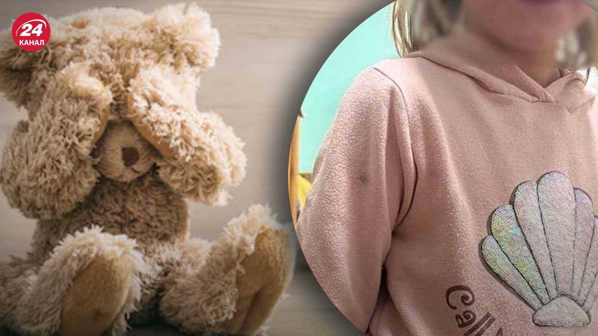 Насилие над детьми - воспитательница Киевской области до крови избила ребенка Насилие над детьми - воспитательница Киевской области до крови избила ребенка