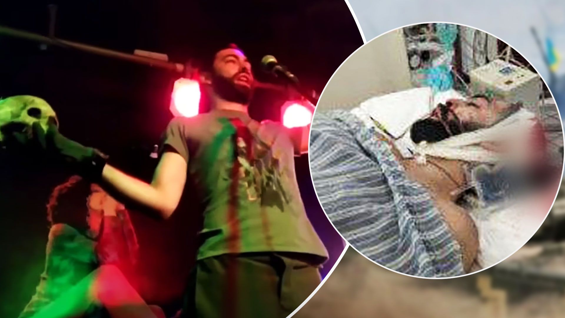 Ігорю Мангушеву прострелили череп 4 лютого 2023 - що відомо про Ігоря Мангушева - 24 Канал Ігорю Мангушеву прострелили череп 4 лютого 2023 - що відомо про Ігоря Мангушева - 24 Канал