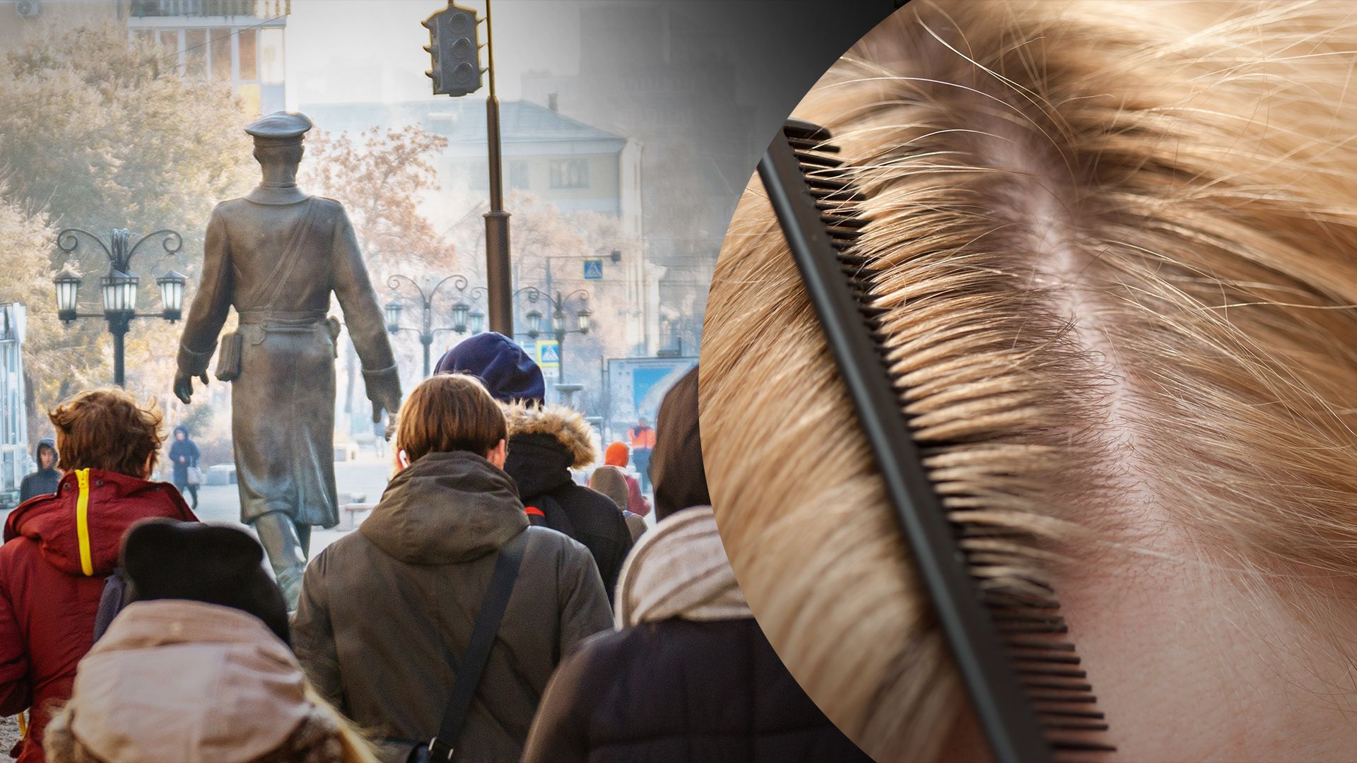 У Самарській області спалахнула епідемія педикульозу У Самарській області спалахнула епідемія педикульозу