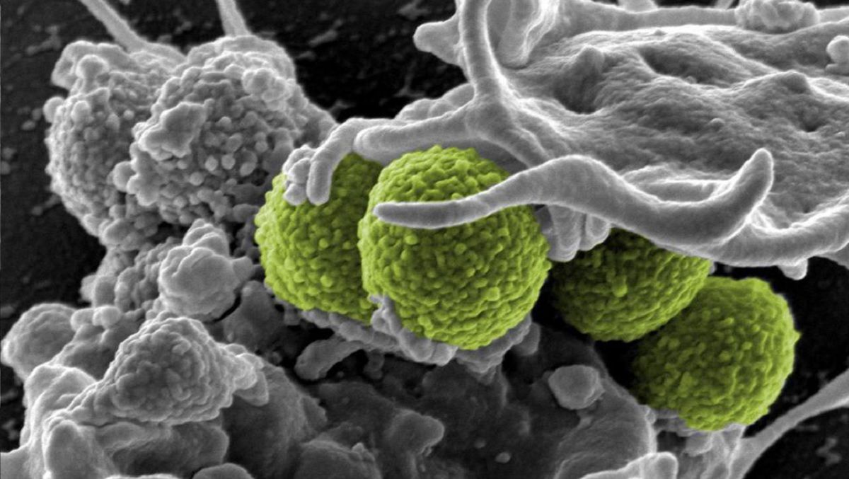 Стійкі до метициліну бактерії золотистого стафілококу (MRSA) серед білих кров'яних тілець людини Стійкі до метициліну бактерії золотистого стафілококу (MRSA) серед білих кров'яних тілець людини