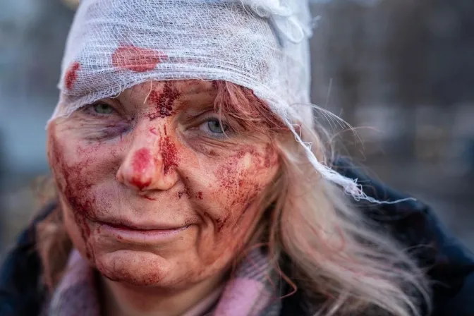 Жінка отримала поранення під час обстрілу Чугуєва