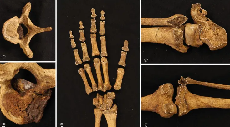 Людські останки, виявлені на Готланді Людські останки, виявлені на Готланді