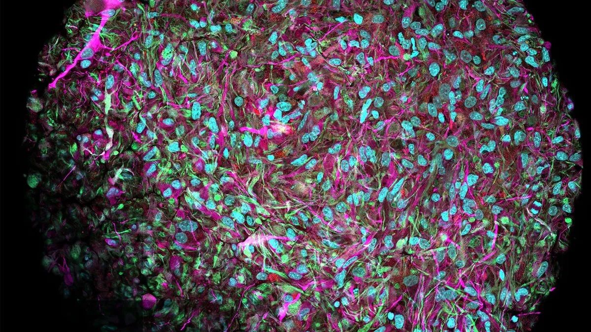 Увеличенное изображение органоида мозга, полученное в лаборатории Томаса Хартунга