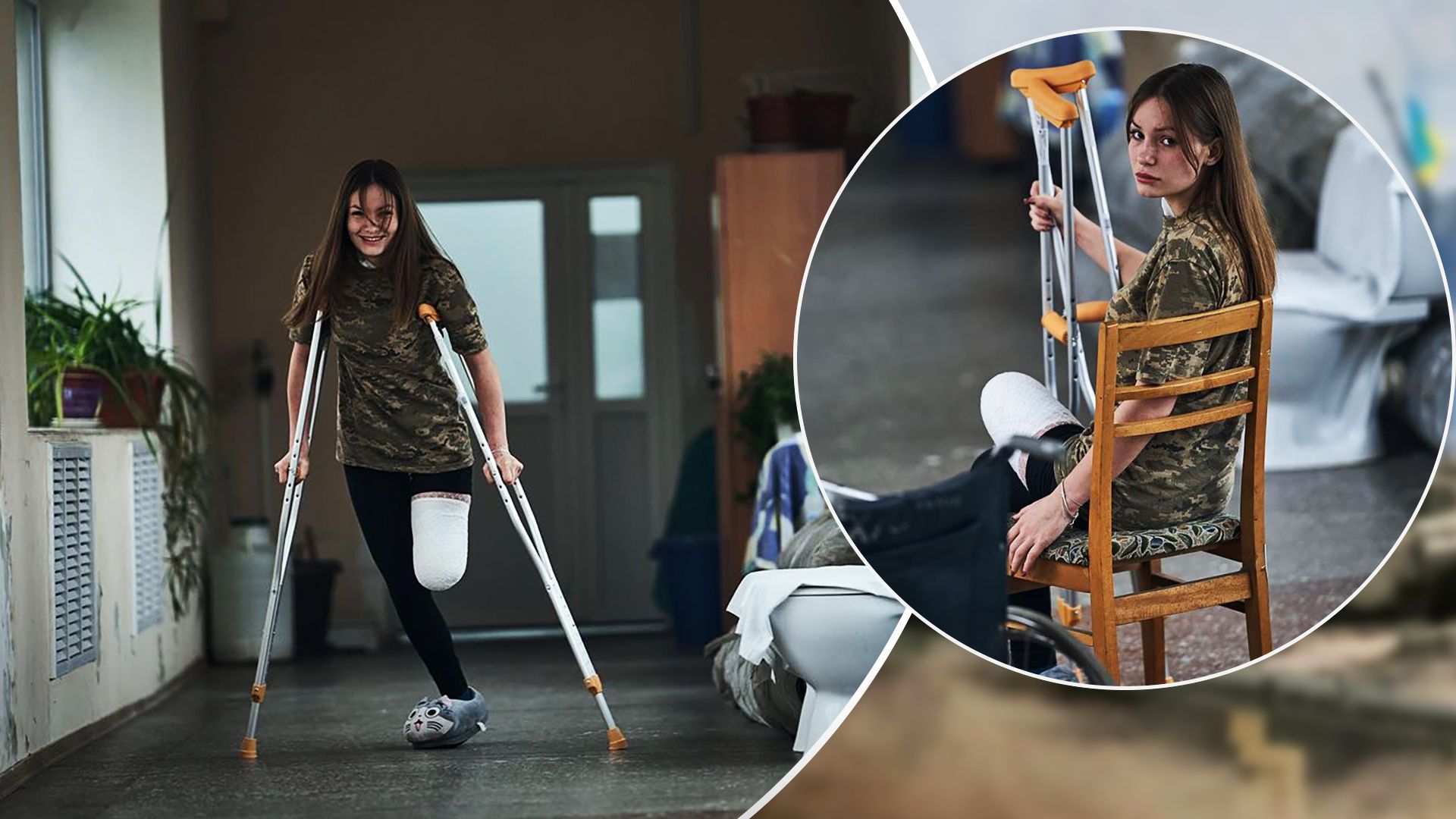 Руслана Данилкина рассказала о жутком ранении, когда она потеряла ногу