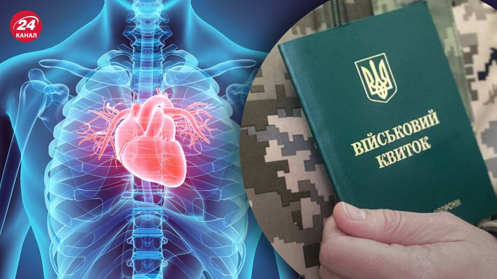Мобілізація в Україні 2023 - перелік хвороб серця, що звільняють від мобілізації 