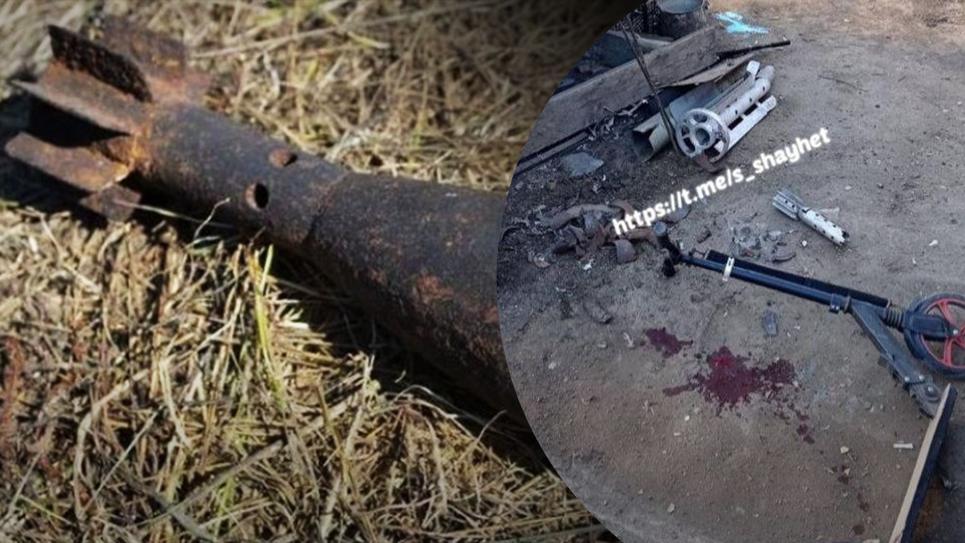 Під Миколаєвом чоловік приніс снаряд на подвір'я: той здетонував і поранив маленького хлопчика - 24 Канал