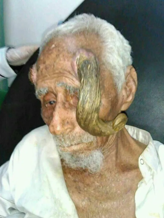 Рог Али Антера был на уровне его рта / CEN Рог Али Антера был на уровне его рта / CEN