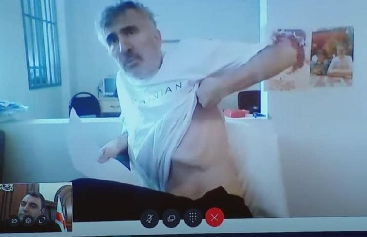 Міхеіл Саакашвілі у критичному стані - польським медикам дозволили оглянути політика Міхеіл Саакашвілі у критичному стані - польським медикам дозволили оглянути політика