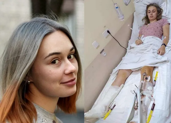 Галя Николин до и после аварии Галя Николин до и после аварии