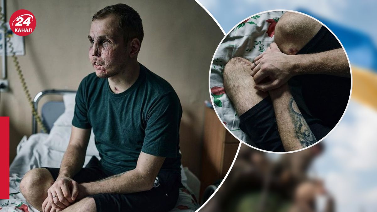 Военный ВСУ Сергей, практически потерявший зрение на фронте Военный ВСУ Сергей, практически потерявший зрение на фронте