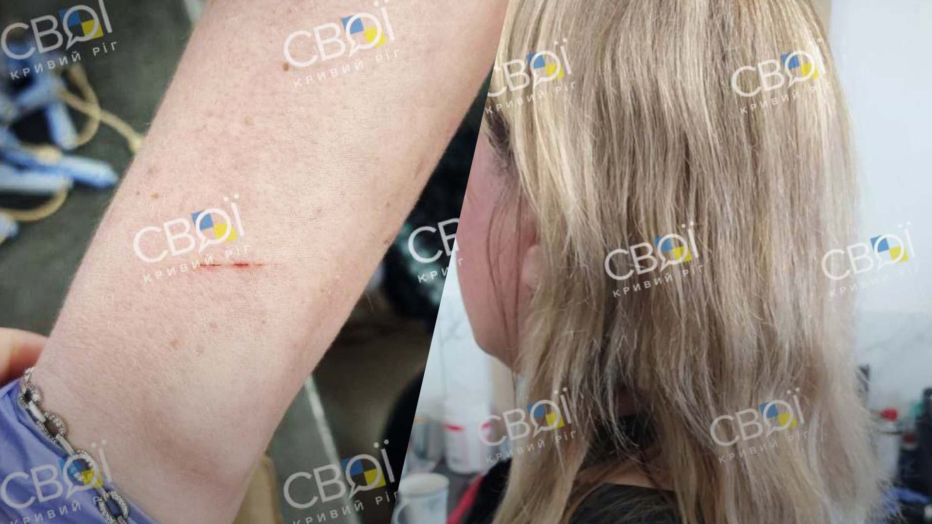 Мріяла помститись за стрижку: у Кривому Розі невдоволена клієнтка порізала перукарку - 24 Канал Мріяла помститись за стрижку: у Кривому Розі невдоволена клієнтка порізала перукарку - 24 Канал