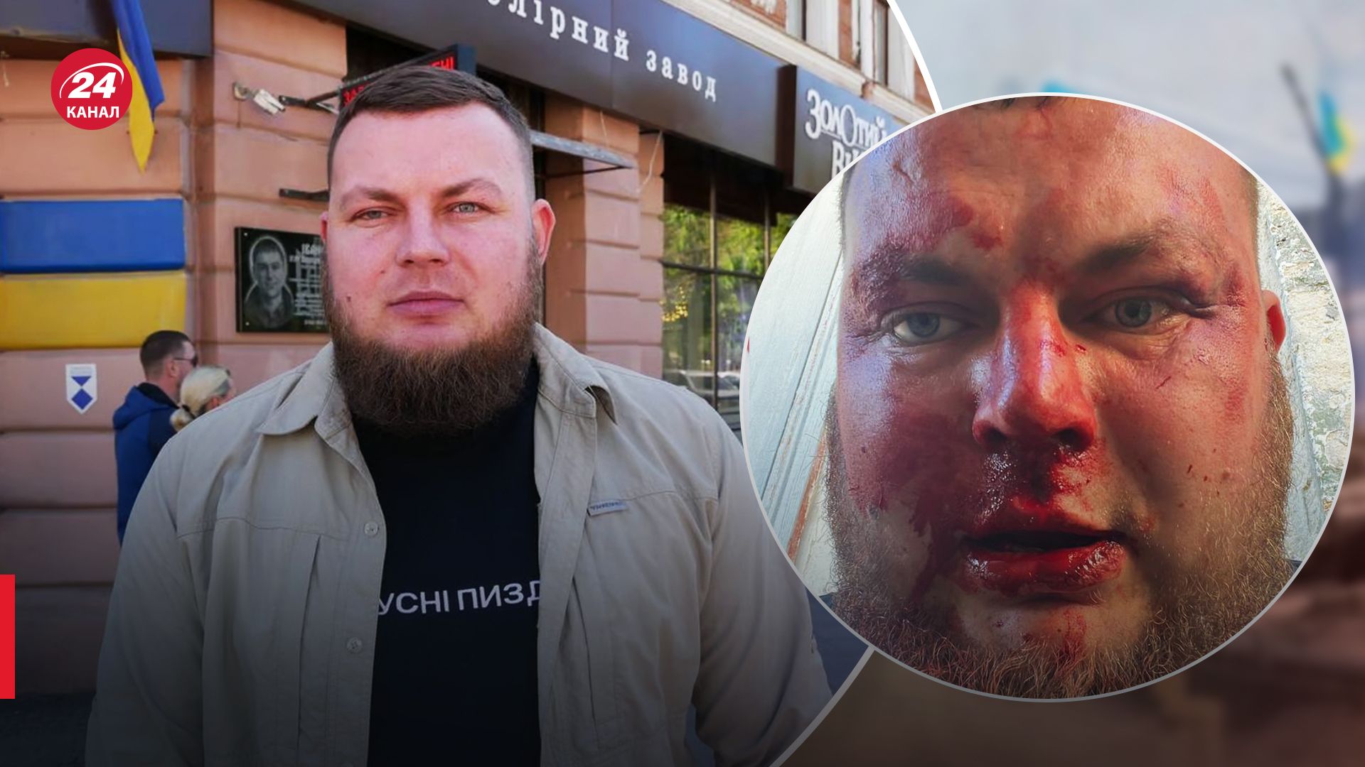 В Одесі побили громадського діяча Дем'яна Ганула В Одесі побили громадського діяча Дем'яна Ганула