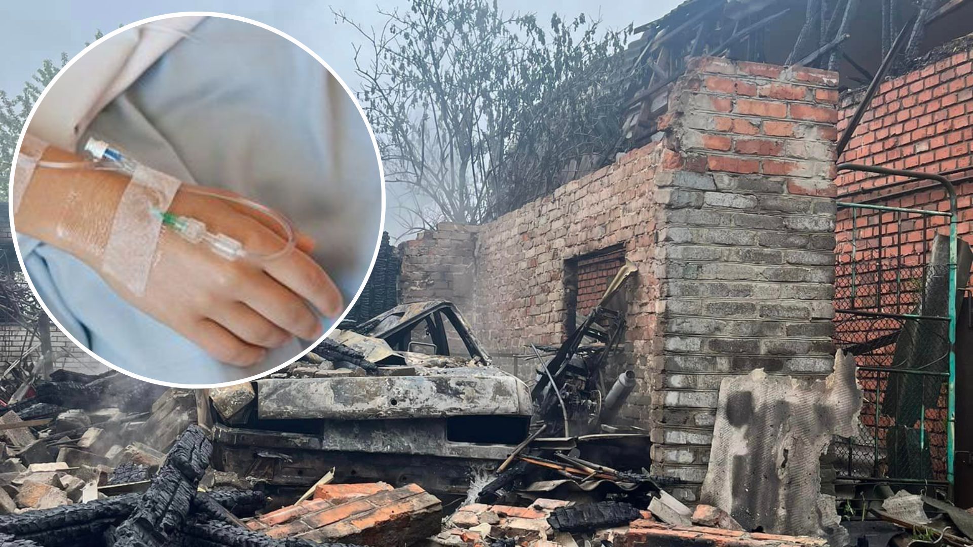 Обстріл Краматорська 29 квітня - у лікарні померла постраждала 16-річна дівчина - 24 Канал Обстріл Краматорська 29 квітня - у лікарні померла постраждала 16-річна дівчина - 24 Канал