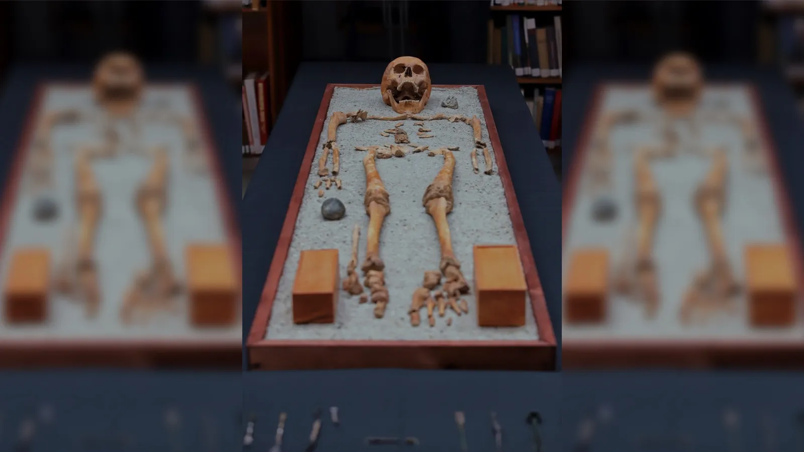 Скелет лікаря Скелет лікаря