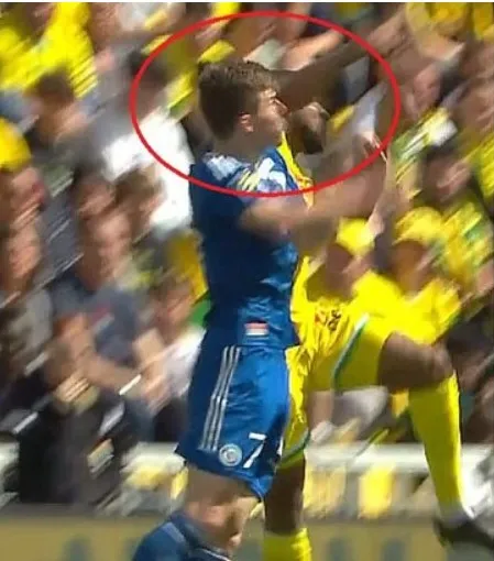 Соболь отримав травму Соболь отримав травму