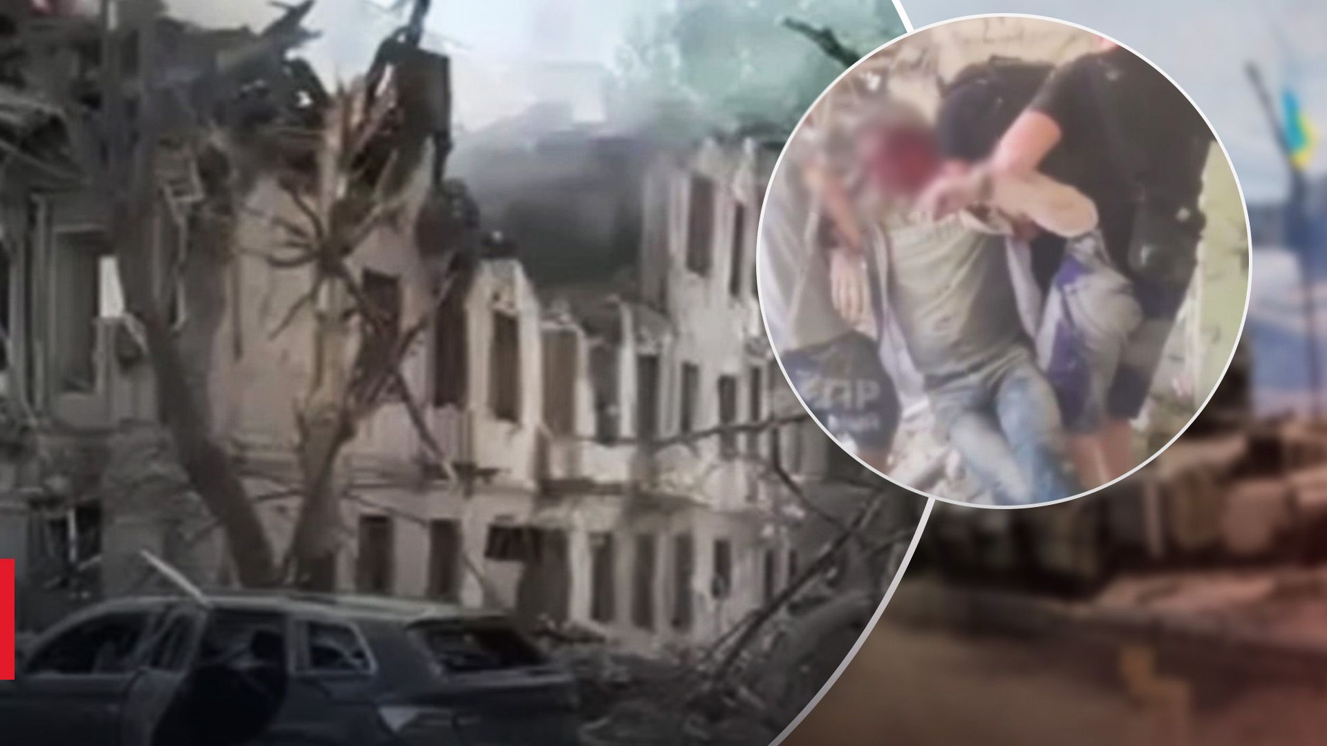 Поранений чоловік увесь у крові: з'явилось відео із лікарні Дніпра, в яку поцілили окупанти - 24 Канал