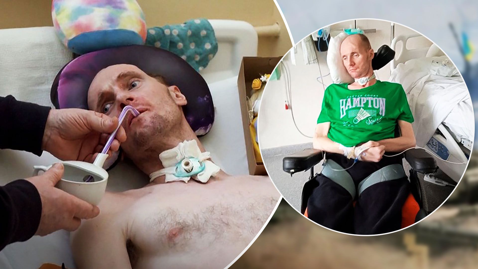 Поранений боєць Віталій Шумей вперше заговорив - Віталій Шумей лікується в Іспанії - 24 Канал Поранений боєць Віталій Шумей вперше заговорив - Віталій Шумей лікується в Іспанії - 24 Канал