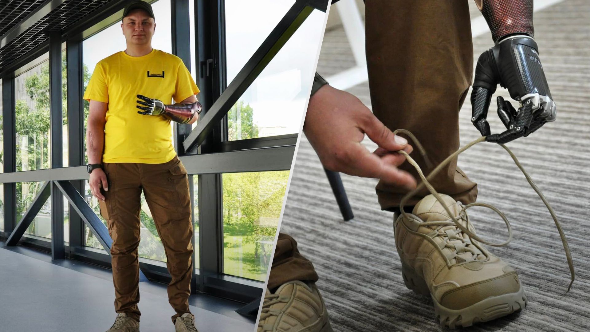 Роман после протезирования продолжает сбывать мечты Роман после протезирования продолжает сбывать мечты