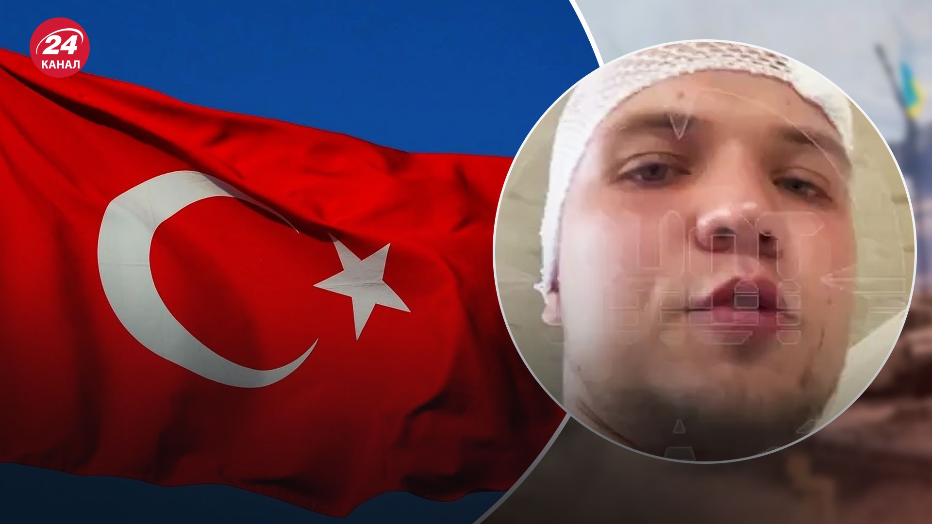 У Туреччині росіянина побили стільцем у готелі
