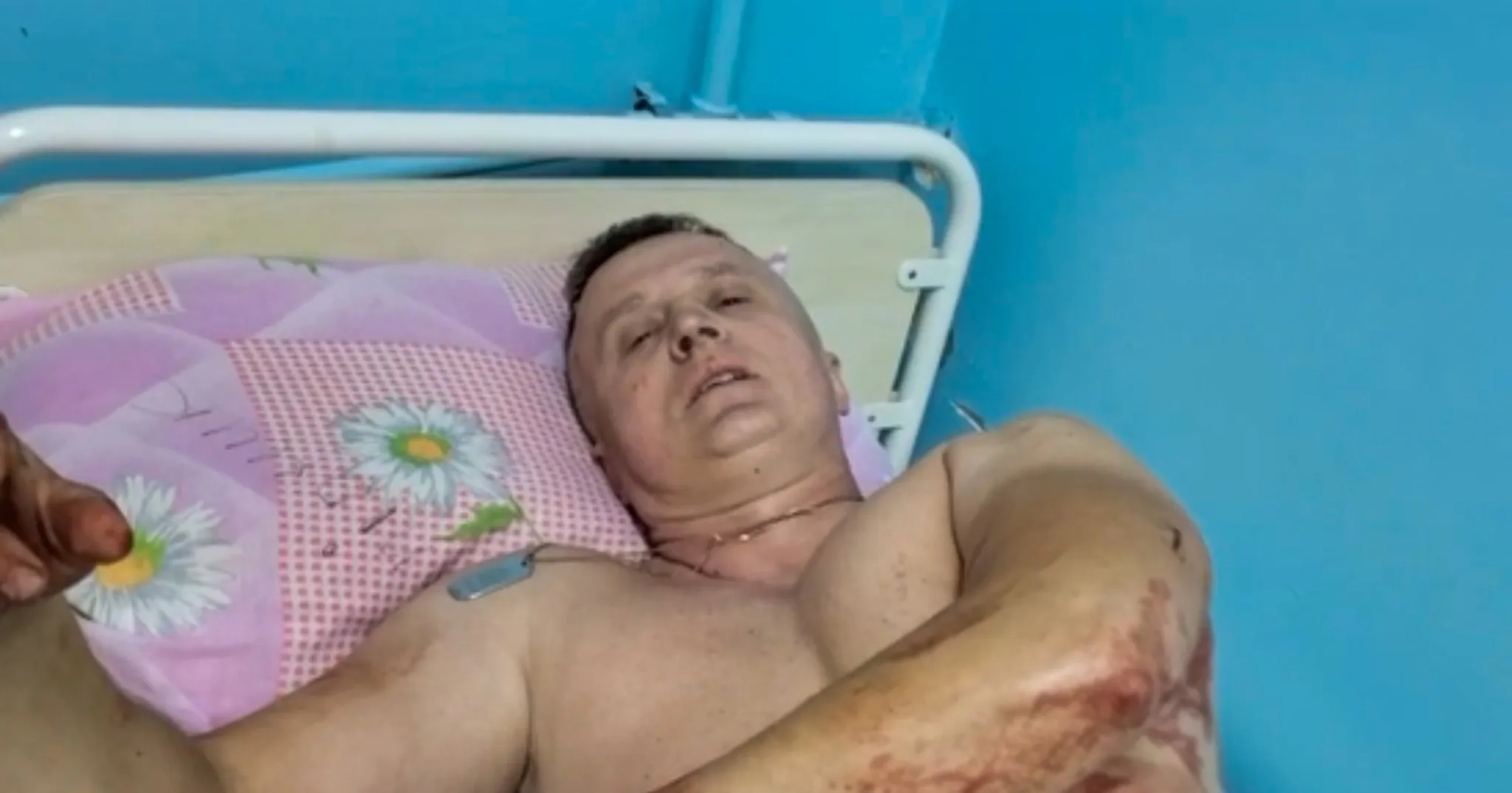 Раненый Владимир в больнице