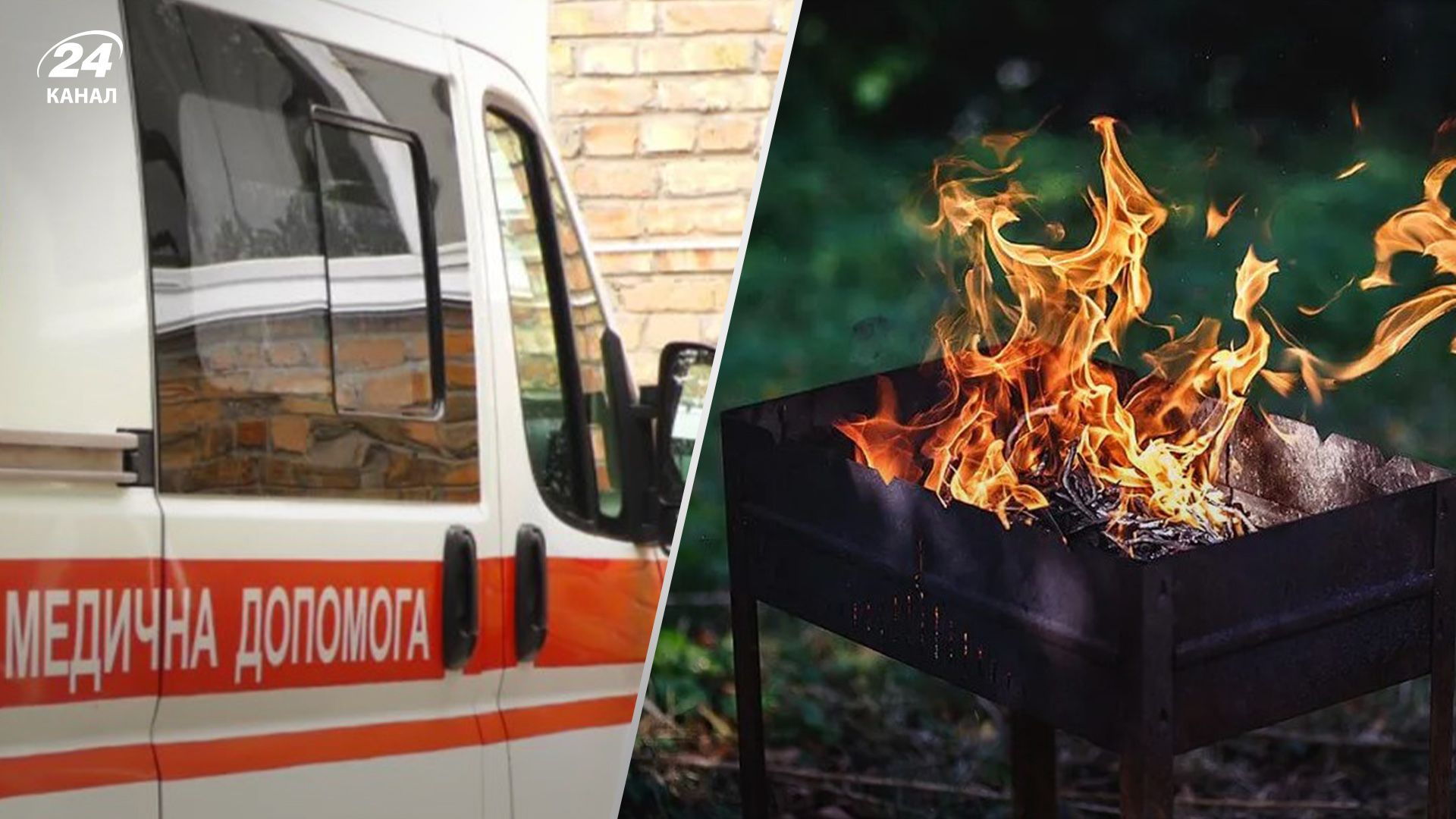 В Одеській області 4-річна дитина загорілася через мангал