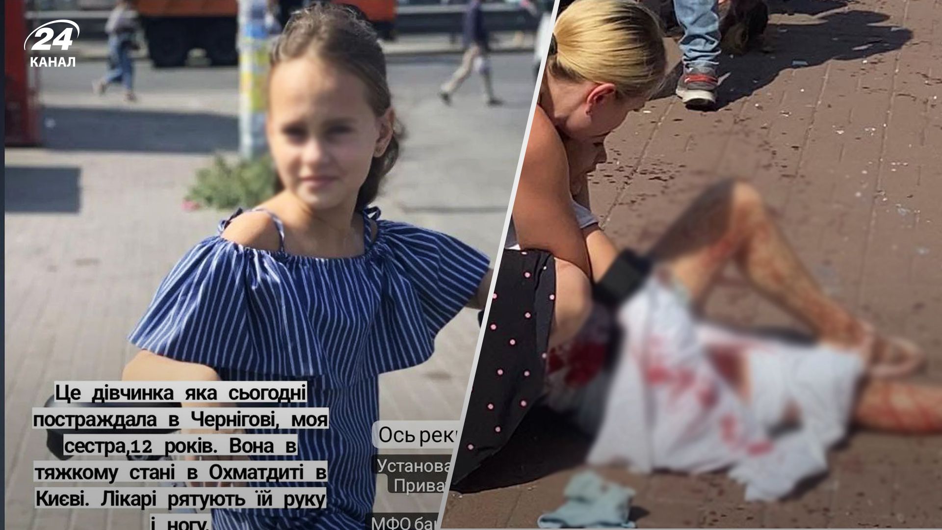 У якому стані 12-річна дівчинка, яку терміново доправили в Київ після удару по Чернігову - 24 Канал