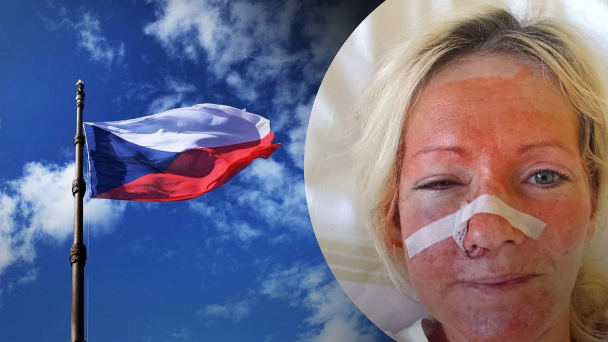 У Чехії побили жінок за те, що вони українки У Чехії побили жінок за те, що вони українки