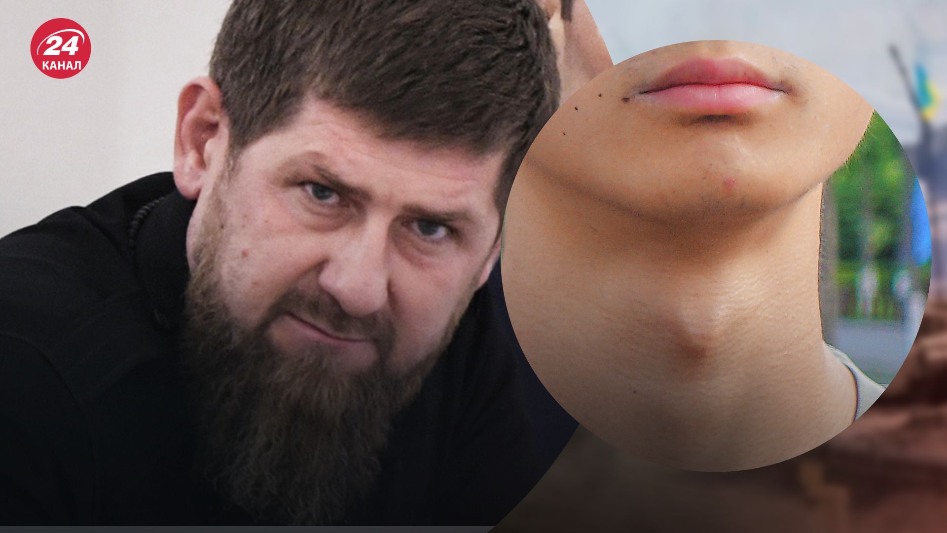 Боты не различают де Кадыров, а где кадык Боты не различают де Кадыров, а где кадык