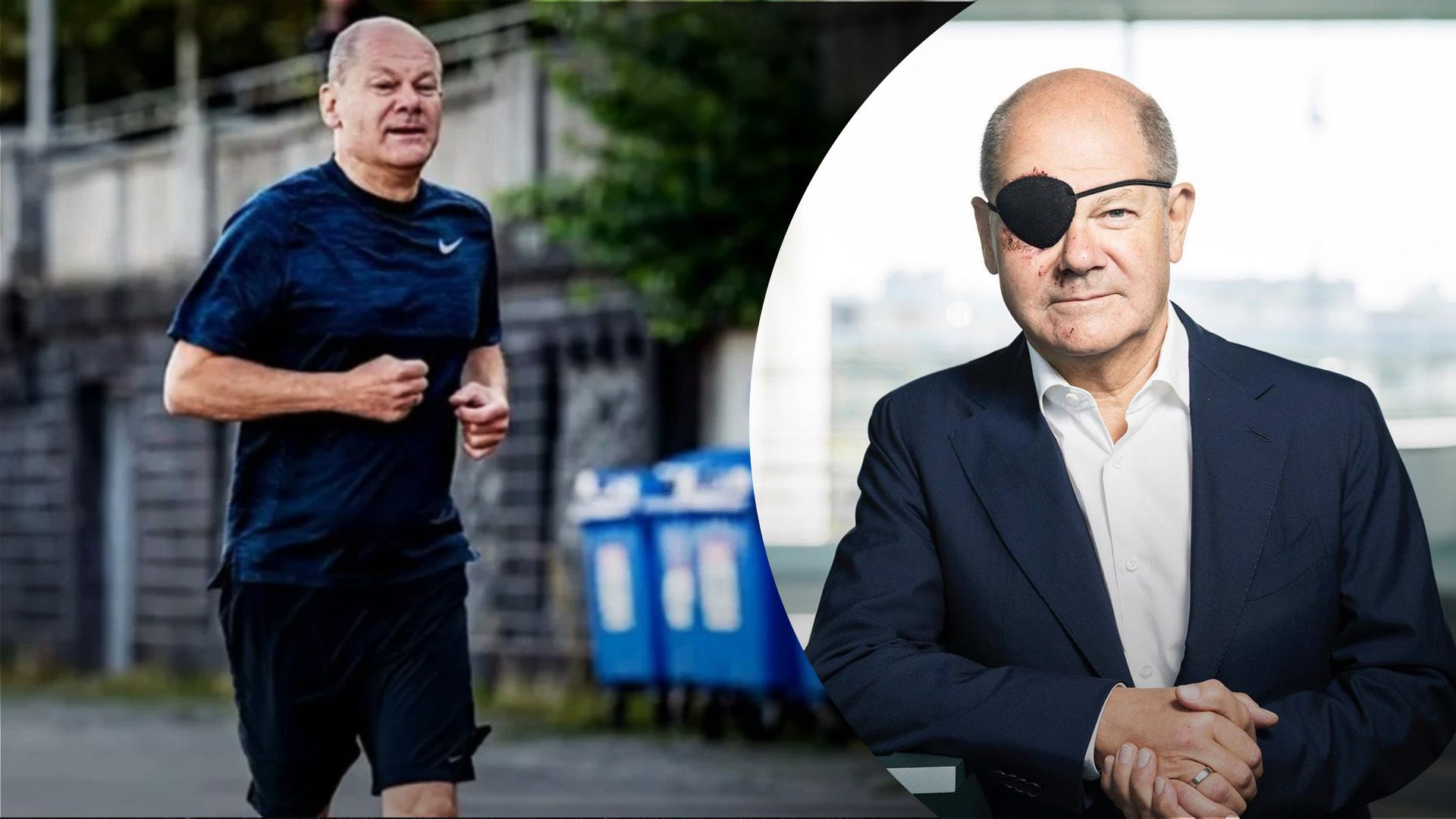 Шольц опубликовал фото после падения на пробежке Шольц опубликовал фото после падения на пробежке