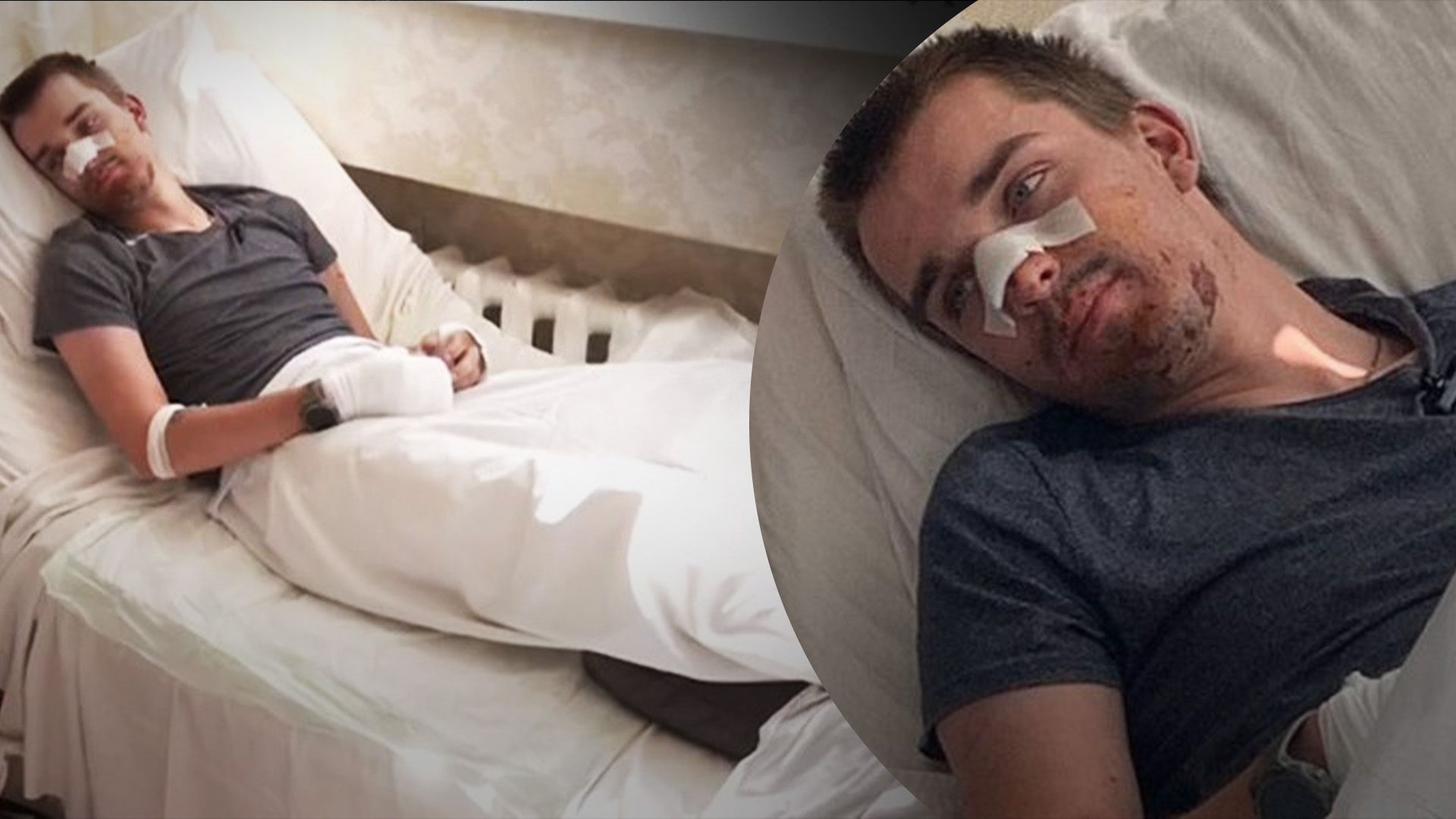 Волонтер з Німеччини розповів, як йому вдалося вижити після атаки росіян Волонтер з Німеччини розповів, як йому вдалося вижити після атаки росіян