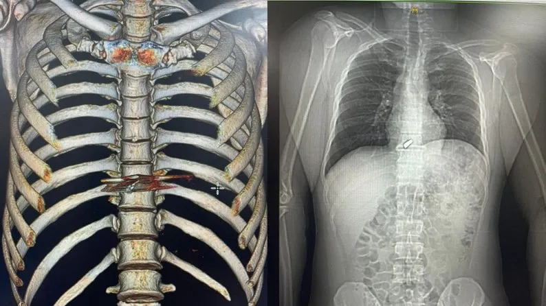 Пуля добралась до сердца Пуля добралась до сердца