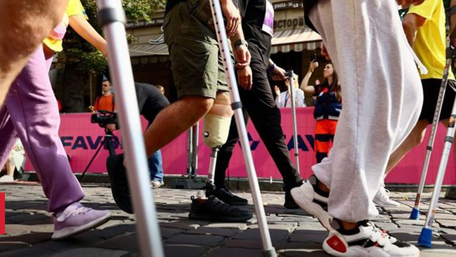 Безкоштовне протезування в Україні Безкоштовне протезування в Україні