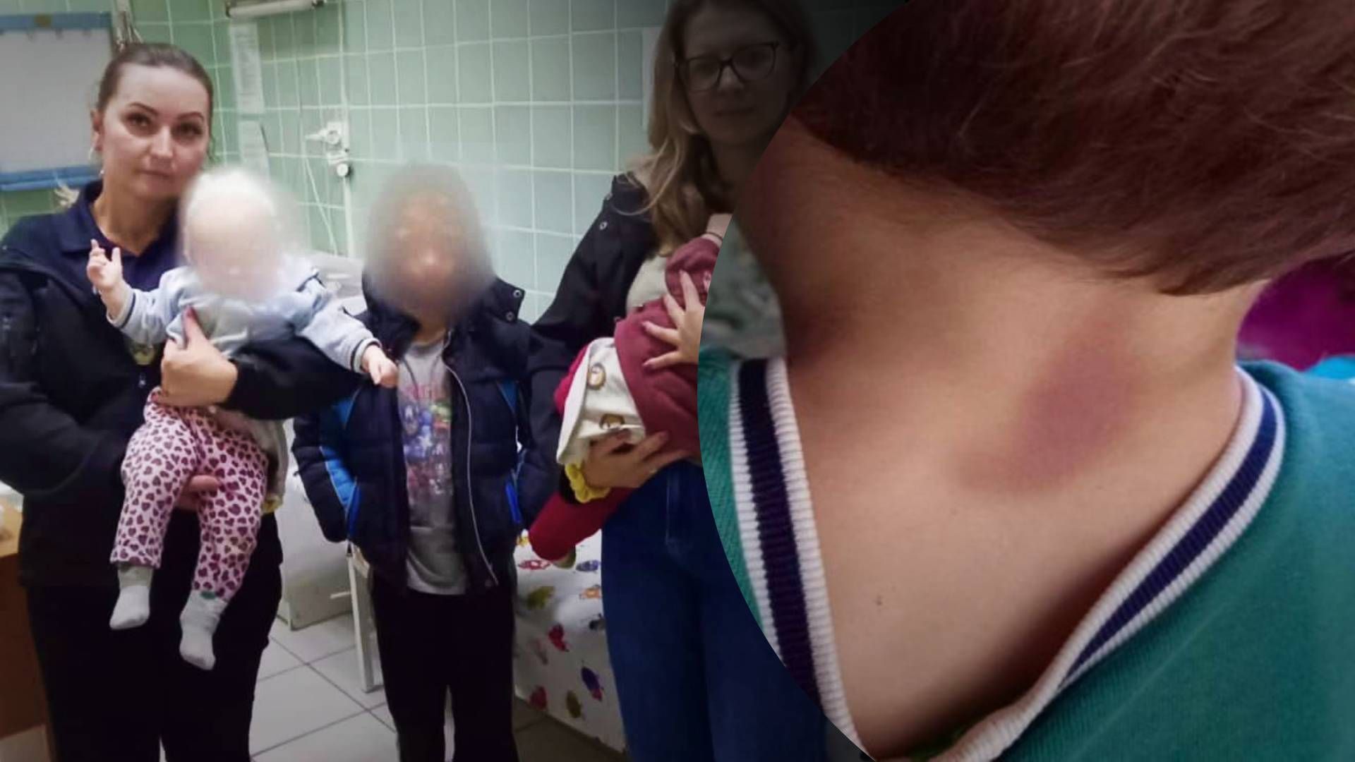 В Ивано-Франковской области избили 6-летнего мальчика - 24 Канал В Ивано-Франковской области избили 6-летнего мальчика - 24 Канал