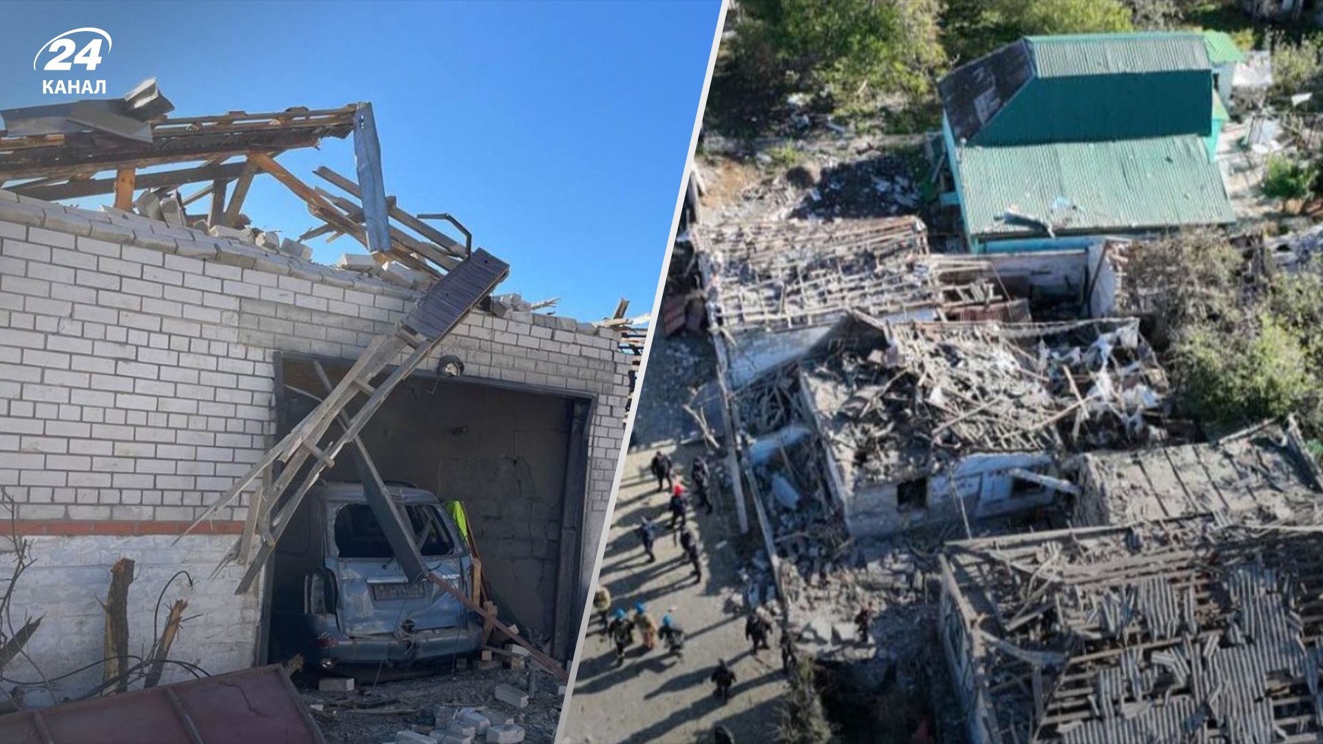 Медики розповіли про поранену дитину в Обухівці Медики розповіли про поранену дитину в Обухівці