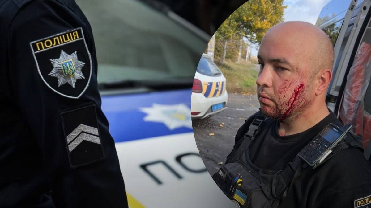 Чоловік завдав собі ушкоджень, а потім поранив поліцейського, який намагався йому завадити Чоловік завдав собі ушкоджень, а потім поранив поліцейського, який намагався йому завадити