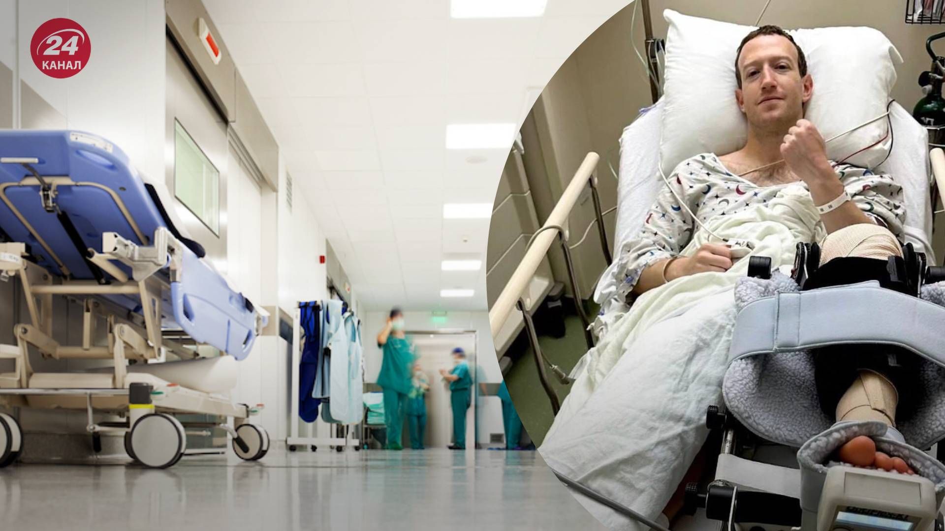 Цукерберг травмировался во время боя Цукерберг травмировался во время боя