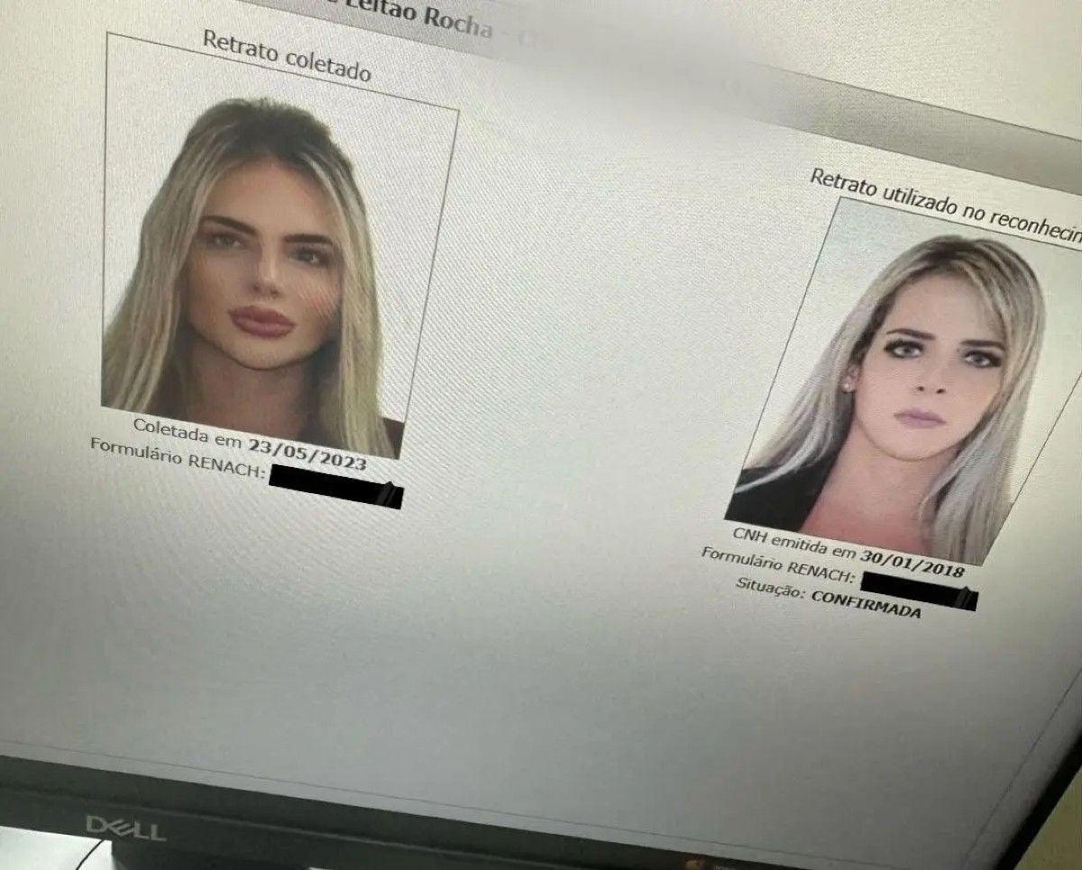 Дівчина за останні роки зробила кілька пластичних операцій