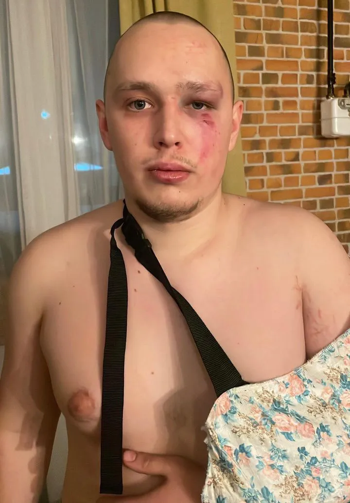 Ранение на теле Алексея Иванина