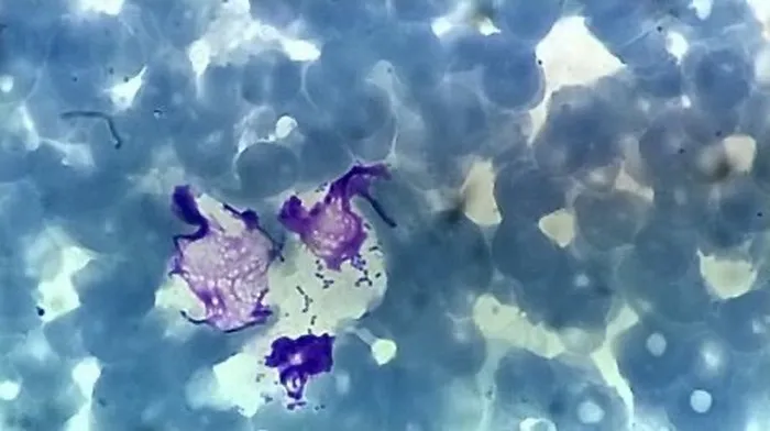 Бактерии, присутствующие в мазке крови одного из слонов