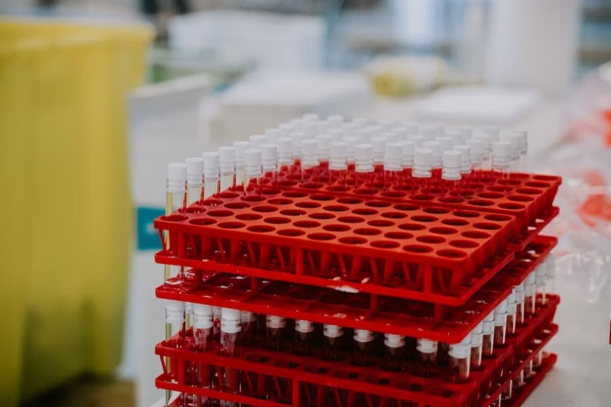 AstraZeneca приобретет Gracell AstraZeneca приобретет Gracell