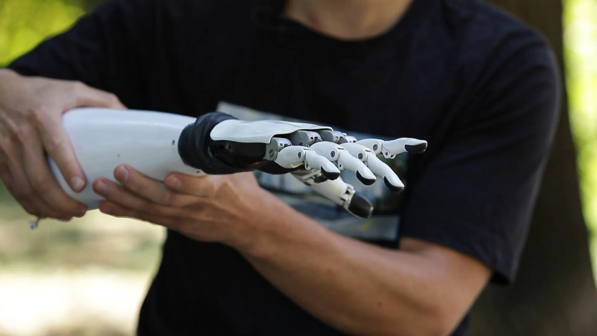 VersiBionics прагнуть зробити протези доступними для українців VersiBionics прагнуть зробити протези доступними для українців