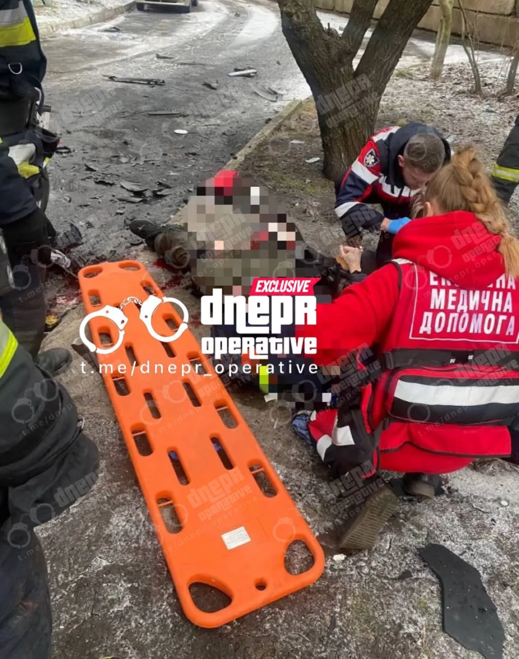 В Днепре после взрыва авто водитель потерял ногу В Днепре после взрыва авто водитель потерял ногу