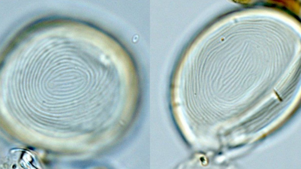 Таємниця стародавніх одноклітинних істот роками ховалася в працях учених Таємниця стародавніх одноклітинних істот роками ховалася в працях учених