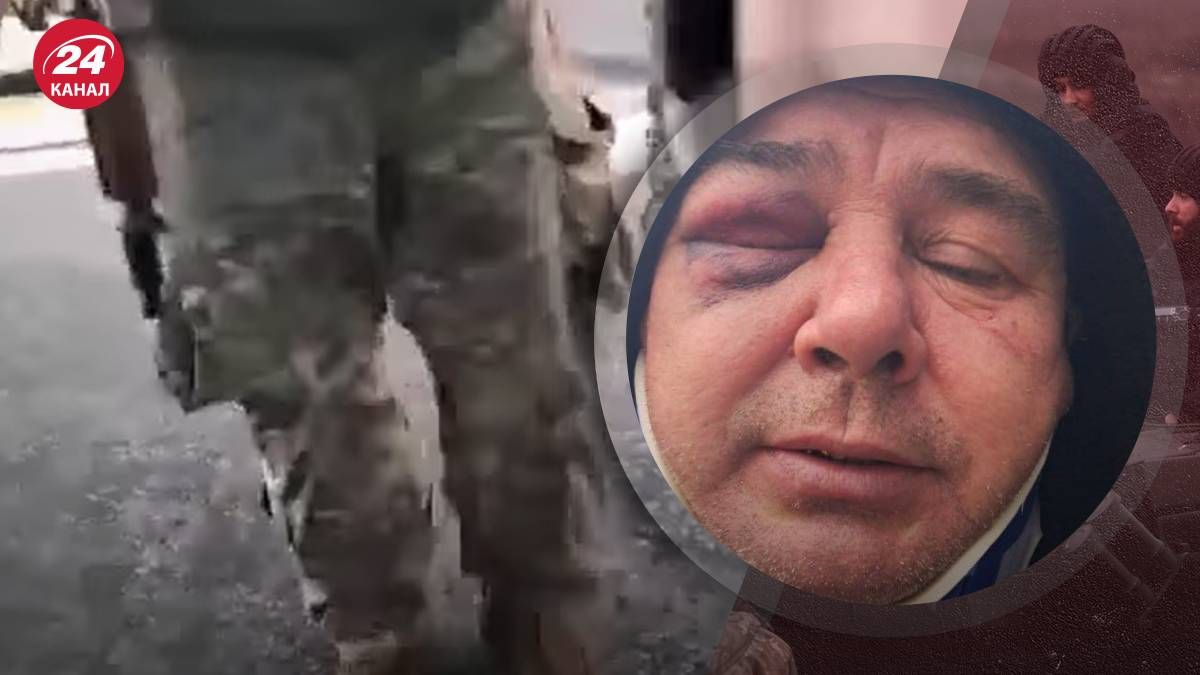 Працівники ТЦК у Київській області побили чоловіка Працівники ТЦК у Київській області побили чоловіка