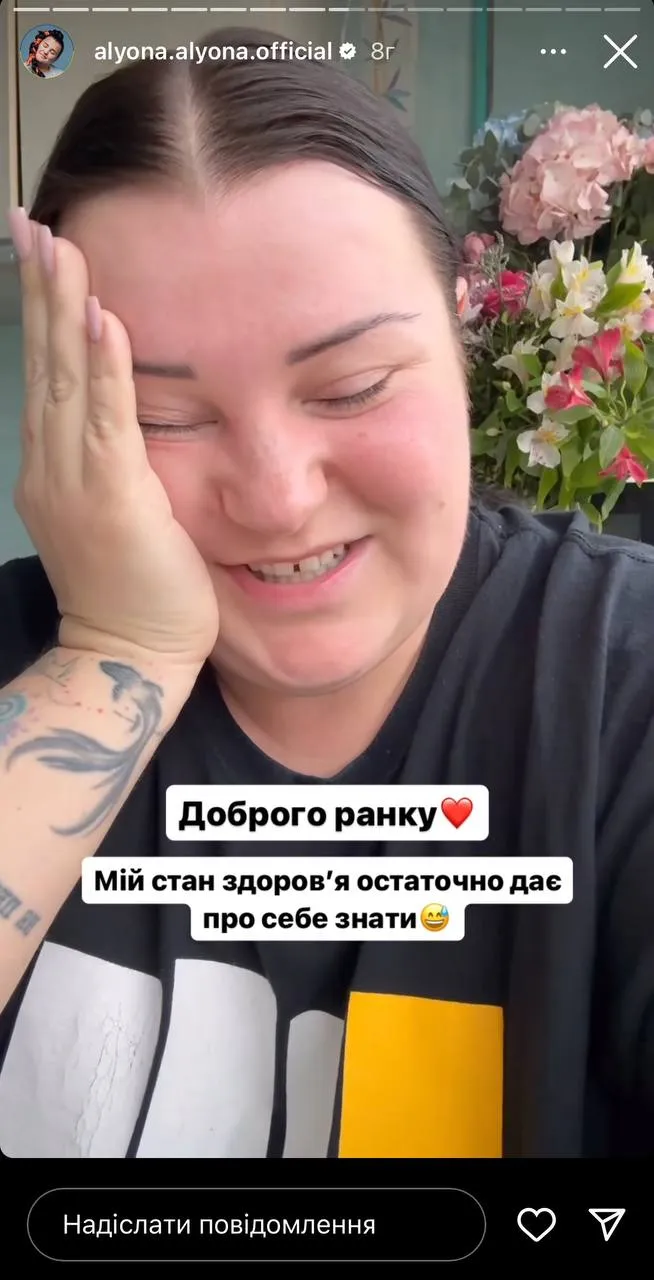 Alyona Alyona поскаржилася на проблеми зі здоров'ям Alyona Alyona поскаржилася на проблеми зі здоров'ям