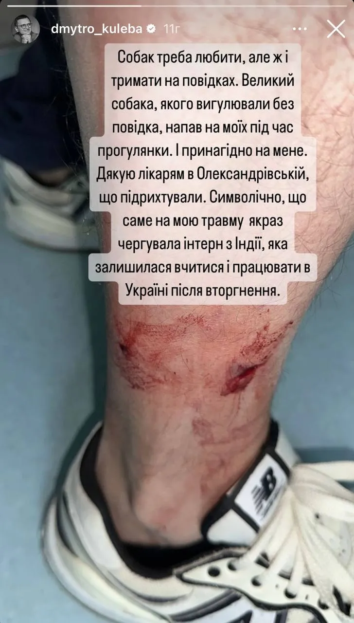 Дмитрий Кулеба стал жертвой нападения собаки - инцидент произошел 11  февраля - 24 Канал